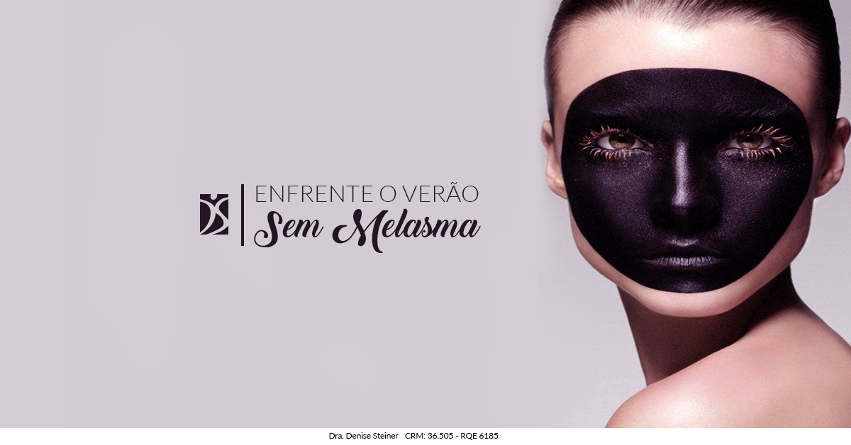 melasma