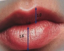 labios-como-deixa-los-mais-bonitos-e-saudaveis