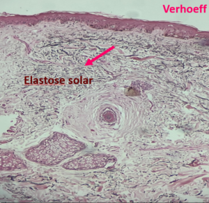 remedio-para-tratar-diabete-e-usado-para-tratar-melasma