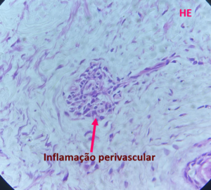 remedio-para-tratar-diabete-e-usado-para-tratar-melasma